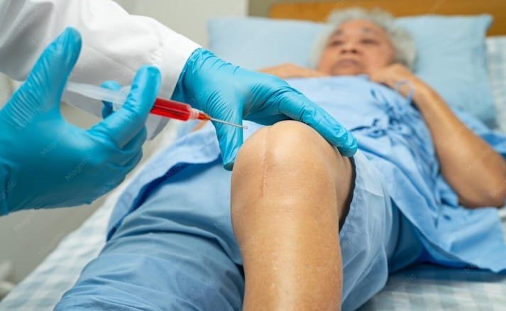 SVF and PRP Injections